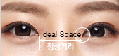 Canthoplasty-5