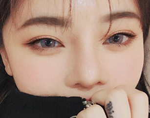 Double Eyelid Surgery In Korea