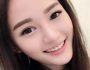 Ptosis Correction (Levator) Korea