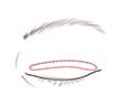 eye-revision-jw-plastic-surgery-clinic-a
