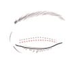 eye-revision-jw-plastic-surgery-clinic-b