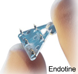 forehead-lift-endotine-korea-1-