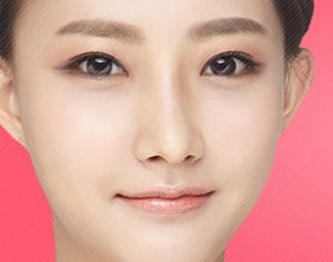 Korean revision eye surgery