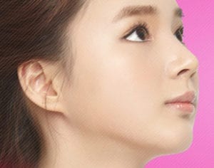 tip plasty korea