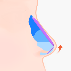 1c