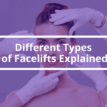 Is a SMAS facelift the same as a deep plane? – Different Types of Facelifts Explained